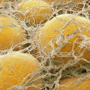 Тест биологический: сможете узнать органы человеческого тела под микроскопом?