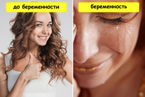 10 необычных фактов о беременности, о которых не говорят врачи