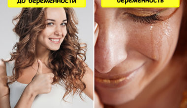 10 необычных фактов о беременности, о которых не говорят врачи