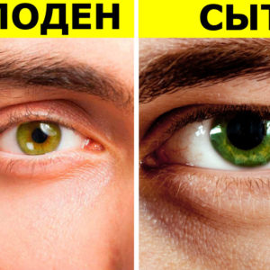 6 вещей, которые изменят цвет ваших глаз (временно или навсегда)