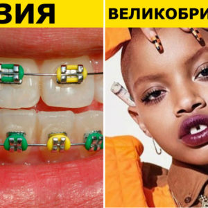 9 изъянов внешности, которые считаются красивыми в других странах