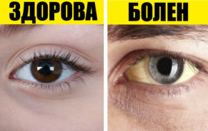 8 симптомов, которые помогут понять, что вам не хватает витаминов
