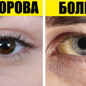 8 симптомов, которые помогут понять, что вам не хватает витаминов