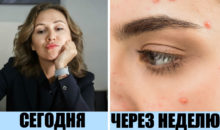 9 ошибок в уходе за собой, которые скажутся и на красоте, и на здоровье