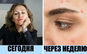 9 ошибок в уходе за собой, которые скажутся и на красоте, и на здоровье
