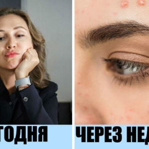 9 ошибок в уходе за собой, которые скажутся и на красоте, и на здоровье