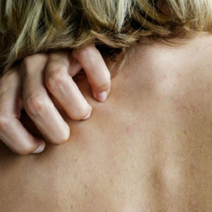 Почему все чешется: 9 неочевидных причин зуда