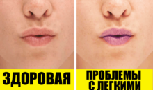 10 скрытых симптомов того, что у вас есть проблемы с легкими