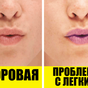 10 скрытых симптомов того, что у вас есть проблемы с легкими