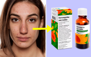 9 средств из аптеки, которые сэкономят кучу денег и порадуют салонным эффектом