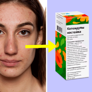 9 средств из аптеки, которые сэкономят кучу денег и порадуют салонным эффектом
