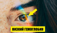 Какие сигналы организма указывают на недостаток гемоглобина? 7 поводов прислушаться к себе