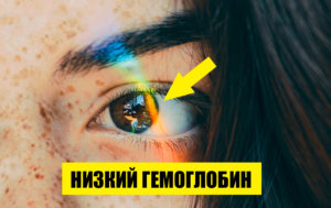 Какие сигналы организма указывают на недостаток гемоглобина? 7 поводов прислушаться к себе