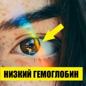Какие сигналы организма указывают на недостаток гемоглобина? 7 поводов прислушаться к себе