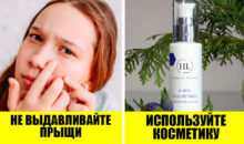 Как помочь подростку справиться с акне? 5 советов от дерматологов