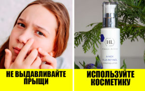 Как помочь подростку справиться с акне? 5 советов от дерматологов