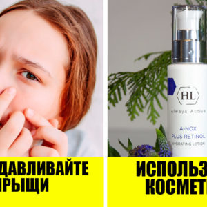 Как помочь подростку справиться с акне? 5 советов от дерматологов
