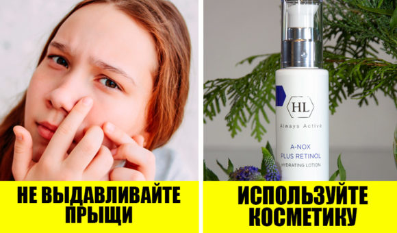 Как помочь подростку справиться с акне? 5 советов от дерматологов