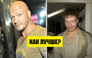 9 "облысевших" звезд – как они выглядели "До" своей фирменной прически?