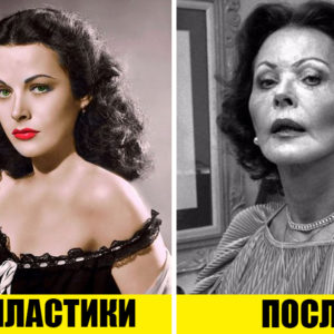 Бой за красоту: 9 актрис Голливуда, которые первыми сделали пластику