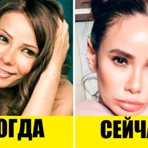 Большая ошибка: 9 звезд, которые напрасно легли под нож хирурга