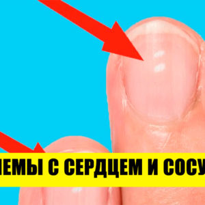 О чем говорят ваши ногти: 12 случаев, когда организм подает сигналы SOS