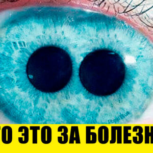 Тест: медицина — ваше призвание, если ответите хотя бы на 9/10 вопросов верно
