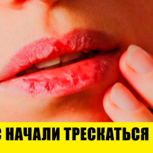 10 незаметных признаков серьезных проблем со здоровьем