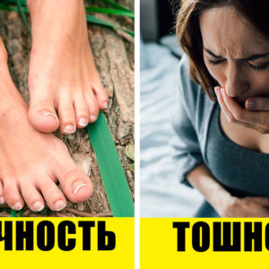 7 намеков на то, что у вас образовался тромб: как предотвратить трагедию?