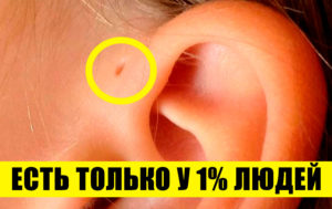 10 редких особенностей человеческого тела: проверьте, насколько вы уникальны
