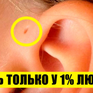 10 редких особенностей человеческого тела: проверьте, насколько вы уникальны