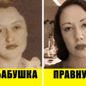 12 случаев, когда генетика сотворила настоящее чудо