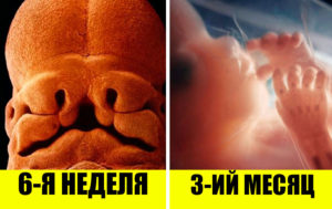 С момента зачатия до рождения: 10 уникальных фото развития ребенка