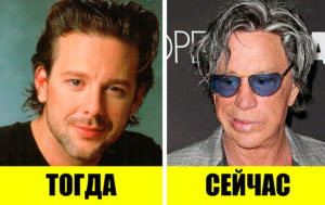 10 подурневших звезд, которые с годами стали совсем непохожи на себя