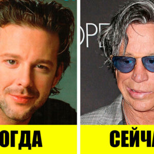 10 подурневших звезд, которые с годами стали совсем непохожи на себя