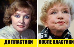 5 красивых и 5 ужасающих результатов пластической хирургии
