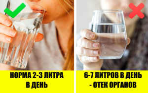 Еда, которая убивает:  9 продуктов, которые могут стать смертельным оружием