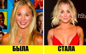 Стыдно, когда видно: 9 звезд, которые тайно сделали пластику