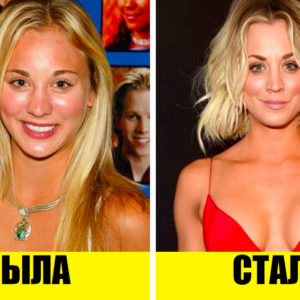 Стыдно, когда видно: 9 звезд, которые тайно сделали пластику
