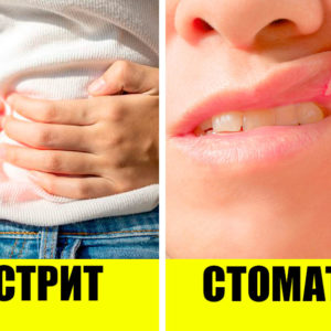 9 неожиданных болезней, передающихся через поцелуи
