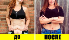 Обвисшая кожа после похудения: почему так происходит, и 8 способов все исправить