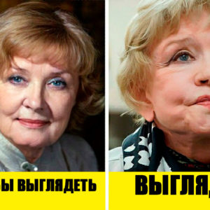 Как выглядели бы 9 знаменитых жертв пластики, если бы их отговорили от операции