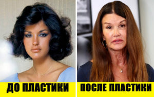 Все на лице написано: 10 неудачных и 10 удачных примеров пластики