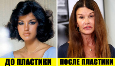 Все на лице написано: 10 неудачных и 10 удачных примеров пластики