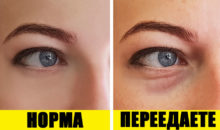 9 признаков чрезмерного употребления соли. Чем это опасно?