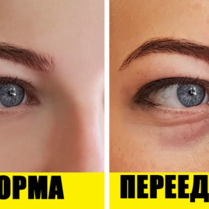 9 признаков чрезмерного употребления соли. Чем это опасно?