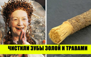 Пикантные истории из жизни в Версале: 8 исторических фактов