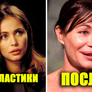 “До” было лучше: как выглядели 10 звезд, пока не помешались на пластике