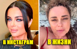 10 русских звезд, которые не умеют скрывать свои недостатки в обычной жизни