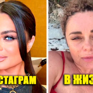 10 русских звезд, которые не умеют скрывать свои недостатки в обычной жизни